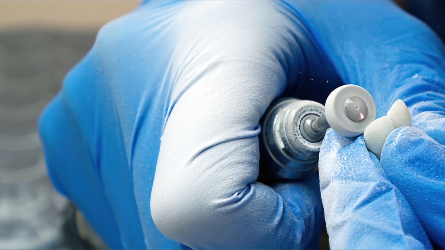 Per un'esperienza del paziente in studio ottimale, il dentista dovrebbe assicurarsi di levigare bene gli artefatti: il giudizio del paziente passa anche attraverso la sensazione tattile linguale